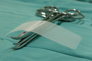 Hemostats used in surgery to implant hernia mesh.