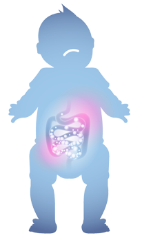 Premature baby with necrotizing enterocolitis.